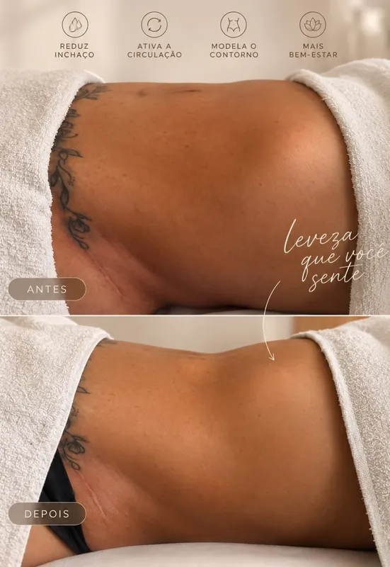 Antes e depois da drenagem linfática no abdômen